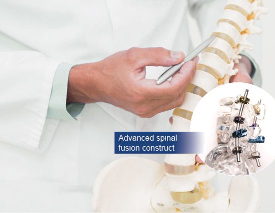 dr michael wong spinal fusion surgery
