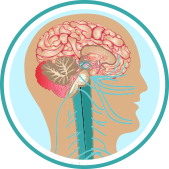 intracranial-problems
