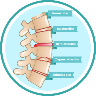 spinal-problems