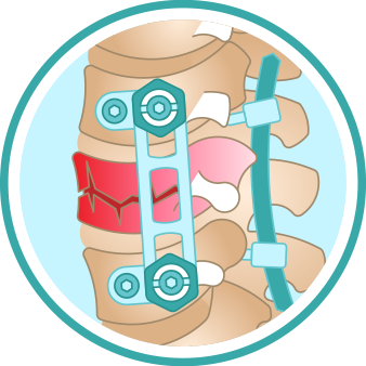 minimally-invasive-and-complex-spinal-surgery